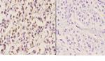 ELL Antibody in Immunohistochemistry (Paraffin) (IHC (P))