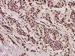 PYCARD Antibody in Immunohistochemistry (Paraffin) (IHC (P))