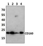 CD160 Antibody in Western Blot (WB)