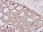 ICAD Antibody in Immunohistochemistry (Paraffin) (IHC (P))