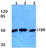 LTBR Antibody in Western Blot (WB)