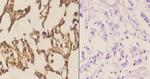 MAP2K4 Antibody in Immunohistochemistry (Paraffin) (IHC (P))