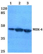 MAP2K4 Antibody in Western Blot (WB)