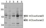 MAP2K4 Antibody in Western Blot (WB)