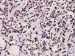 CtBP2 Antibody in Immunohistochemistry (Paraffin) (IHC (P))