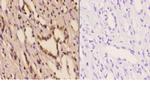 PFKP Antibody in Immunohistochemistry (Paraffin) (IHC (P))