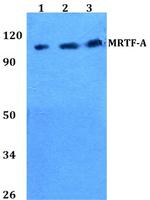 MKL1 Antibody in Western Blot (WB)