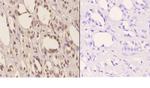 TSG101 Antibody in Immunohistochemistry (Paraffin) (IHC (P))