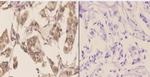 TSG101 Antibody in Immunohistochemistry (Paraffin) (IHC (P))