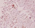 ILKAP Antibody in Immunohistochemistry (Paraffin) (IHC (P))