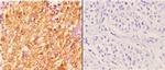 14-3-3 zeta Antibody in Immunohistochemistry (Paraffin) (IHC (P))