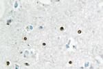 MSH6 Antibody in Immunohistochemistry (Paraffin) (IHC (P))