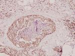 Prothrombin Antibody in Immunohistochemistry (Paraffin) (IHC (P))