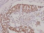 ACVRL1 Antibody in Immunohistochemistry (Paraffin) (IHC (P))