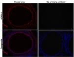 ACVRL1 Antibody in Immunohistochemistry (Paraffin) (IHC (P))