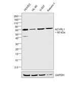 ACVRL1 Antibody in Western Blot (WB)