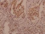 P-cadherin Antibody in Immunohistochemistry (Paraffin) (IHC (P))