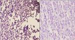 beta-2 Adrenergic Receptor Antibody in Immunohistochemistry (Paraffin) (IHC (P))