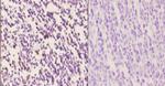 IRF4 Antibody in Immunohistochemistry (Paraffin) (IHC (P))