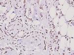 hnRNP M Antibody in Immunohistochemistry (Paraffin) (IHC (P))