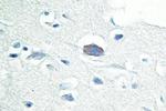 IRAK-M Antibody in Immunohistochemistry (Paraffin) (IHC (P))