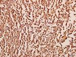 CXCL1 Antibody in Immunohistochemistry (Paraffin) (IHC (P))