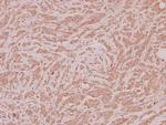 PPT1 Antibody in Immunohistochemistry (Paraffin) (IHC (P))