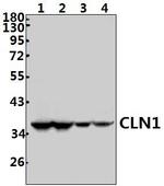 PPT1 Antibody in Western Blot (WB)