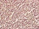 PFKP Antibody in Immunohistochemistry (Paraffin) (IHC (P))