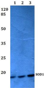 SOD1 Antibody in Western Blot (WB)