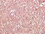 delta Catenin Antibody in Immunohistochemistry (Paraffin) (IHC (P))