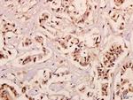 NDUFB10 Antibody in Immunohistochemistry (Paraffin) (IHC (P))