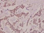 PKC theta Antibody in Immunohistochemistry (Paraffin) (IHC (P))