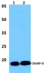 CRABP2 Antibody in Western Blot (WB)