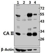 Carbonic Anhydrase II Antibody in Western Blot (WB)