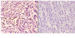 PIK3CA Antibody in Immunohistochemistry (Paraffin) (IHC (P))