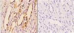 PIK3CA Antibody in Immunohistochemistry (Paraffin) (IHC (P))