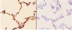 PIK3CA Antibody in Immunohistochemistry (Paraffin) (IHC (P))