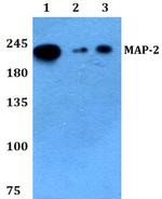 MAP2 Antibody in Western Blot (WB)