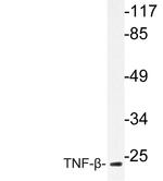 TNF beta Antibody in Western Blot (WB)