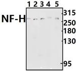 NF-H Antibody in Western Blot (WB)