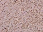 Annexin A3 Antibody in Immunohistochemistry (Paraffin) (IHC (P))