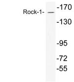 ROCK1 Antibody in Western Blot (WB)