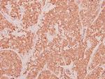 CCL3 Antibody in Immunohistochemistry (Paraffin) (IHC (P))