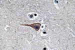 EGF Antibody in Immunohistochemistry (Paraffin) (IHC (P))