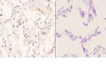 APOE Antibody in Immunohistochemistry (Paraffin) (IHC (P))