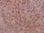 IL5RA Antibody in Immunohistochemistry (Paraffin) (IHC (P))