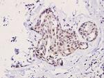 p70 S6 Kinase Antibody in Immunohistochemistry (Paraffin) (IHC (P))