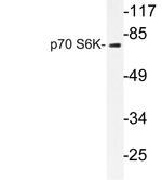 p70 S6 Kinase Antibody in Western Blot (WB)