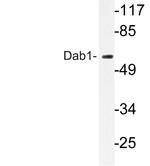DAB1 Antibody in Western Blot (WB)